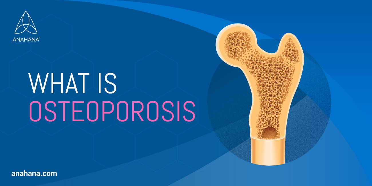 What Is Osteoporosis - Weakening Of The Bones And It's Causes