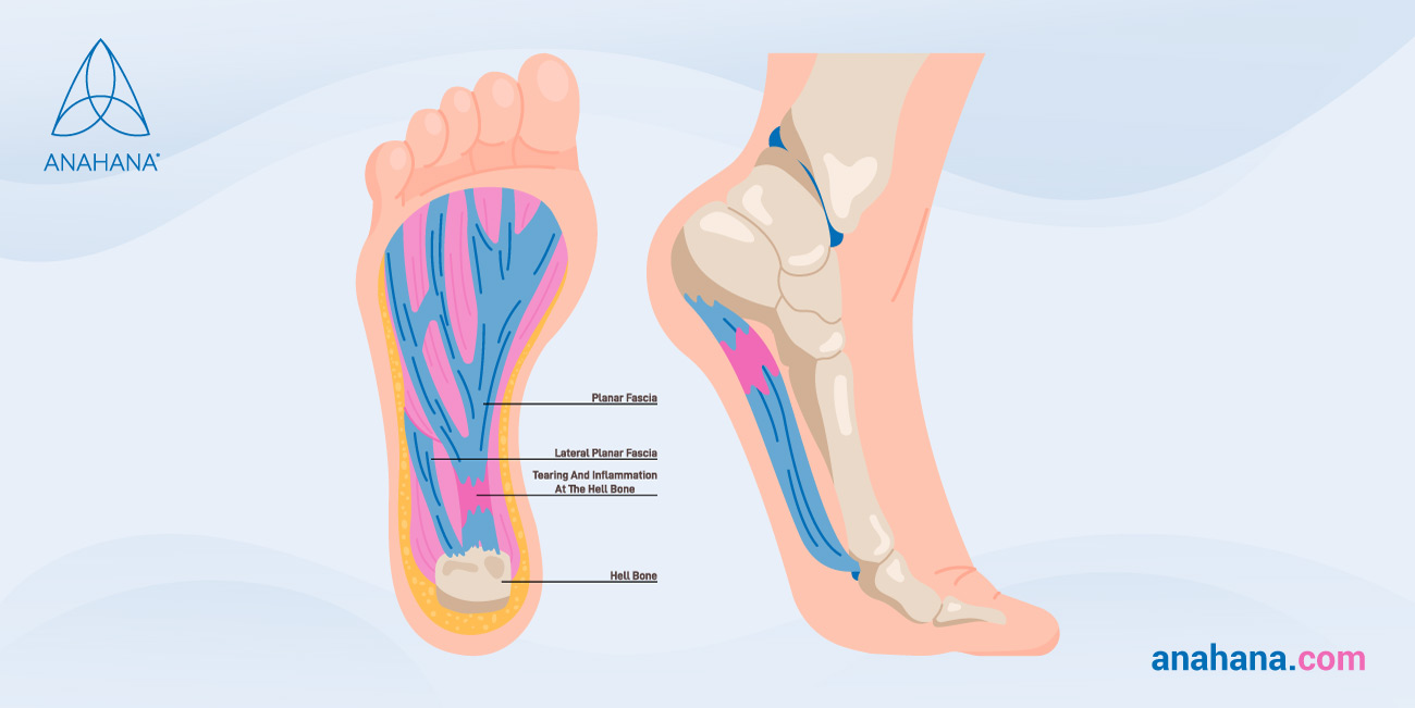 Foot Pain: Healing Solutions for Mitigating Pain