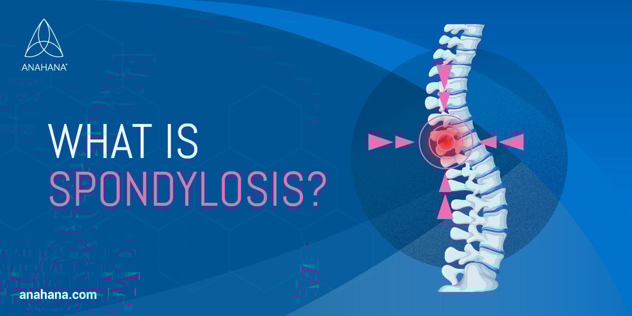 Qu'est-ce que la spondylose